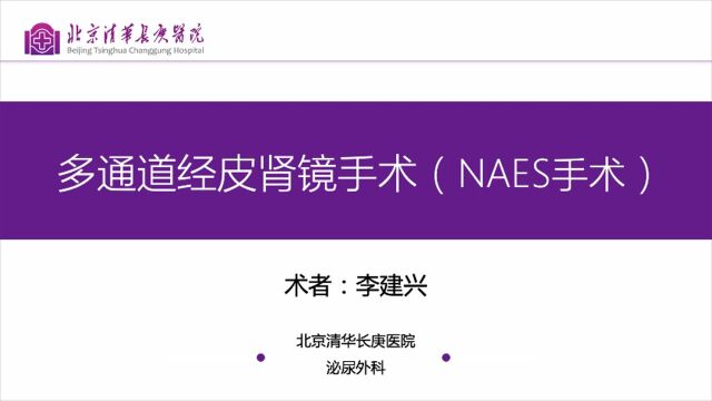 NAES手术(S+N)李建兴教授