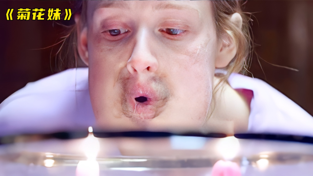 女孩从小长相畸形,菊花和嘴巴互换了位置,一直受尽他人的嘲笑