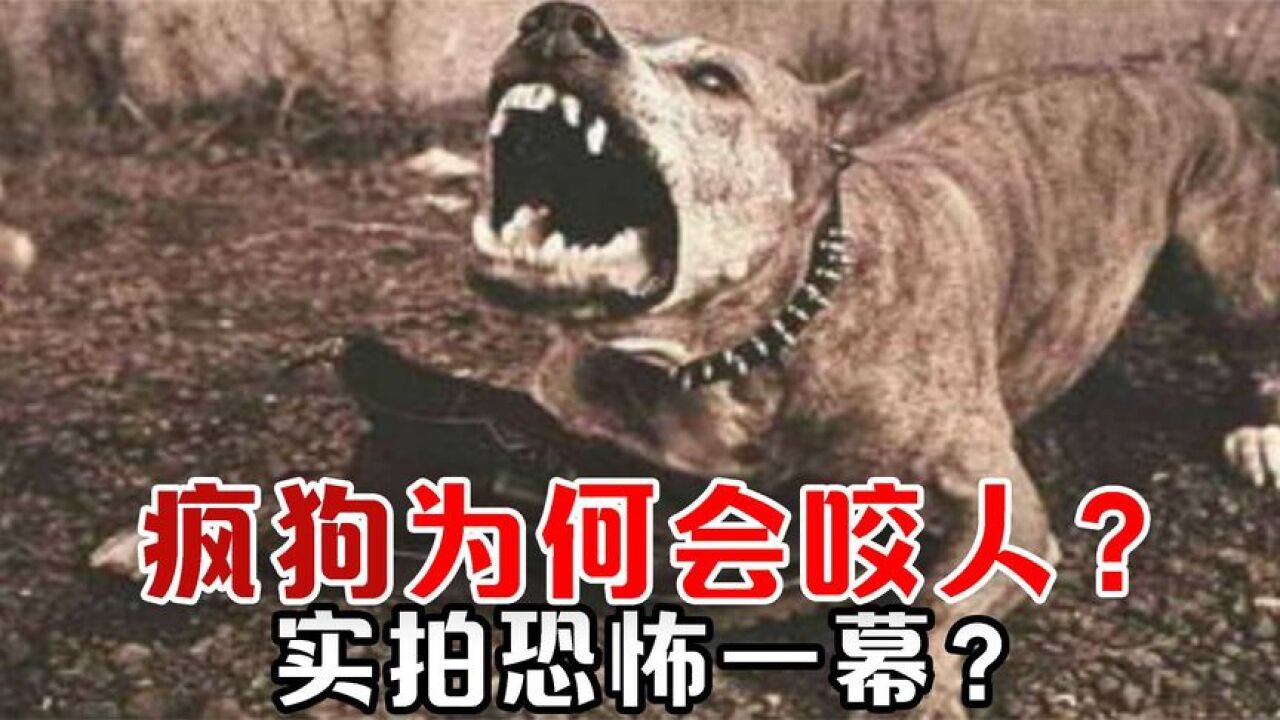 疯狗为何会乱咬人，实拍恐怖一幕，被咬伤后该如何处理..._高清1080P在线观看平台_腾讯视频