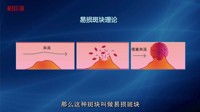 让人意外的是,在所有猝死的病人中,绝大多数是看起来比较正常的人 | 杨进刚