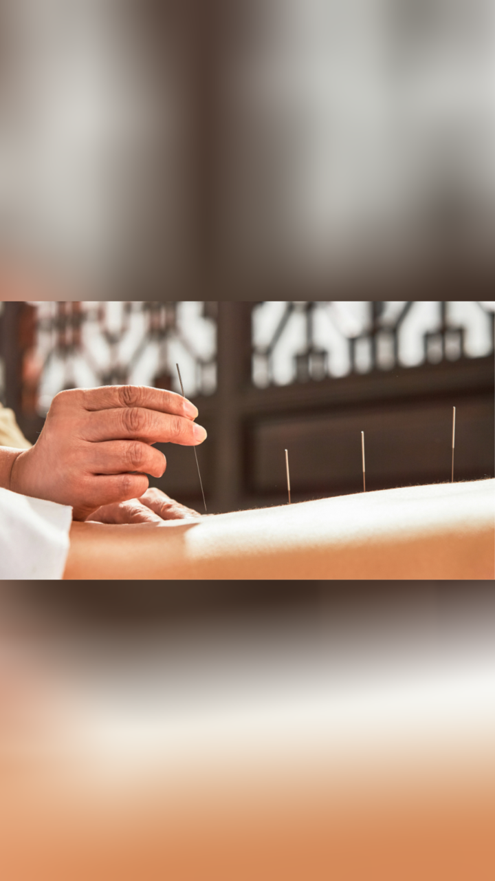 腰间盘突出针灸的治疗方法