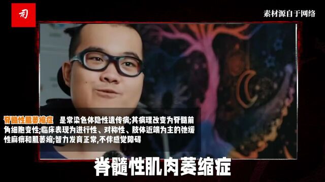 司马南:华裔少年数学天才,微笑天使根根