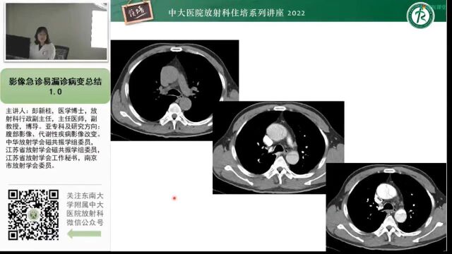 影像急诊易漏诊病变总结中大彭新桂