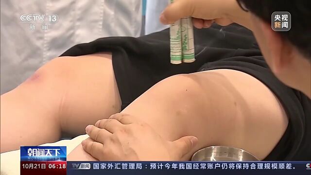 国家卫生健康委:中医医疗卫生机构超8万个 数量稳步增长