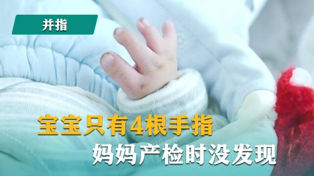 陈江海说并指:宝宝只有4根手指,妈妈产检时没发现