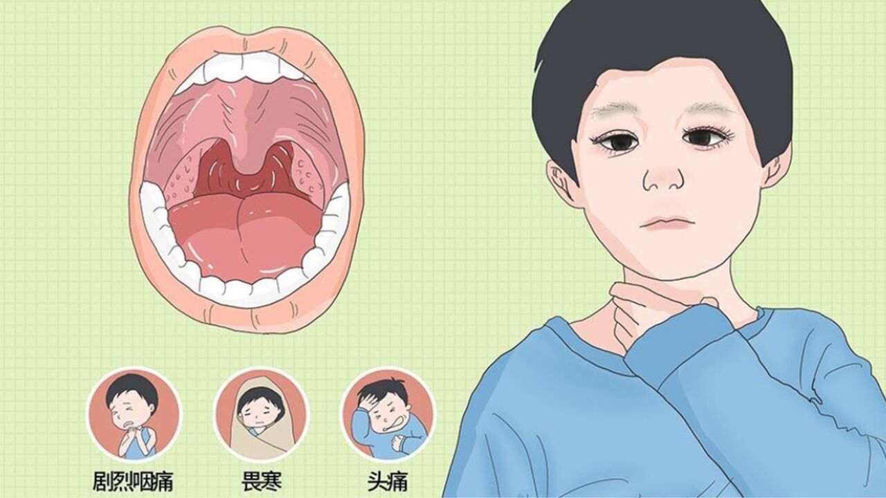 扁桃体发炎,这几种症状最常见,成人和儿童不同,要"区别对待"
