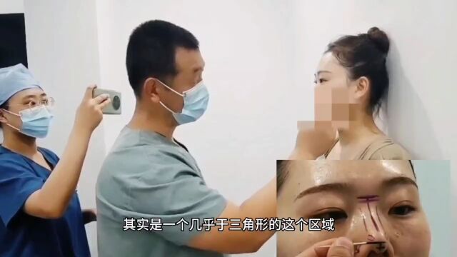 鼻综合整形的术前美学设计画线【张旭东医生】