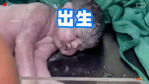 刚出生的小婴儿却没有呼吸，这可把产房里的医护人员急坏了#刚刚出生的小宝宝 #坚强的小生命 #产房故事 #人类幼崽 #新生儿