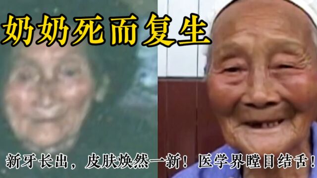 奶奶死而复生,新牙长出,皮肤焕然一新,医学界瞠目结舌