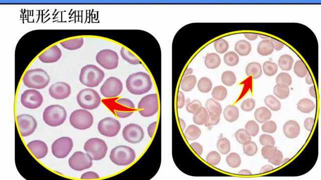 血细胞的显微镜检查_腾讯视频