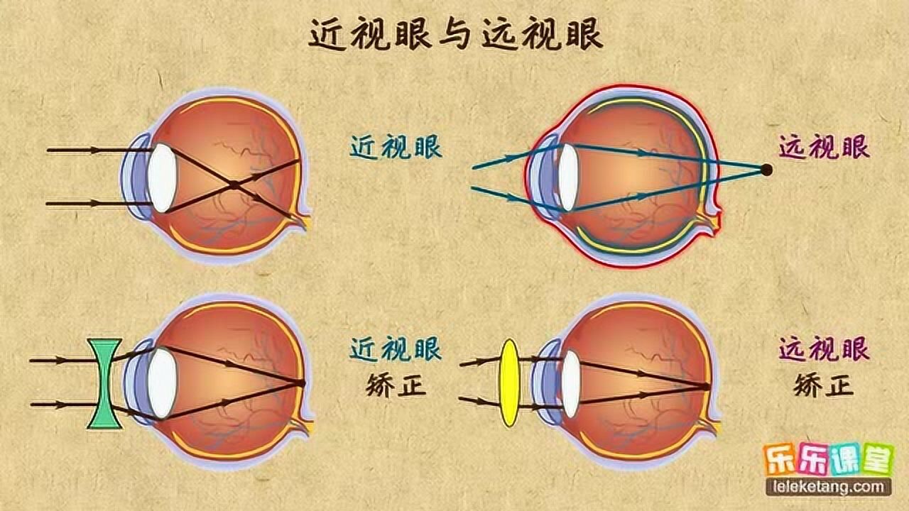 正视你的眼睛：近视眼与远视眼_高清