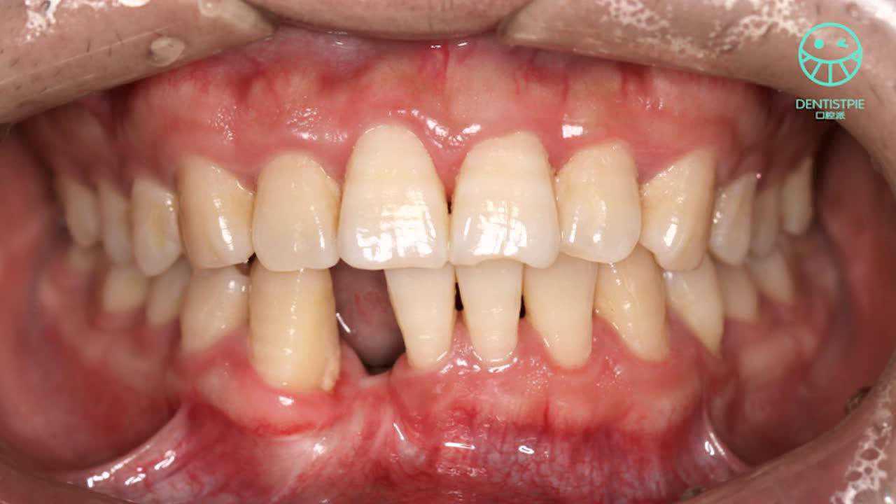 来腾讯视频看更多热门视频