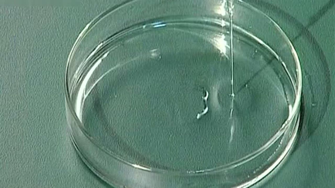 高中生物教材实验演示之观察根尖分生区的有丝分裂_腾讯视频