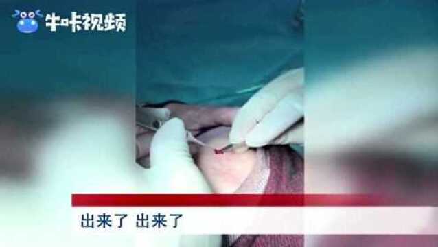 小心蜱虫!死亡率在10%到30%!