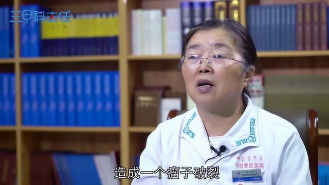 什么是蛛网膜下腔出血