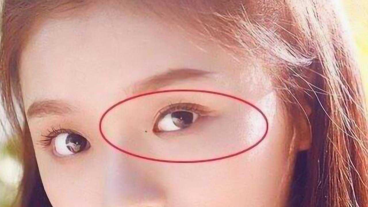 眼角有痣的人特别单纯,一不小心就被骗!