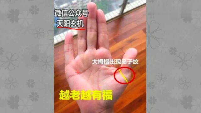 手相“岛子纹”,是福不是祸,之后钱财不断,越老越富贵