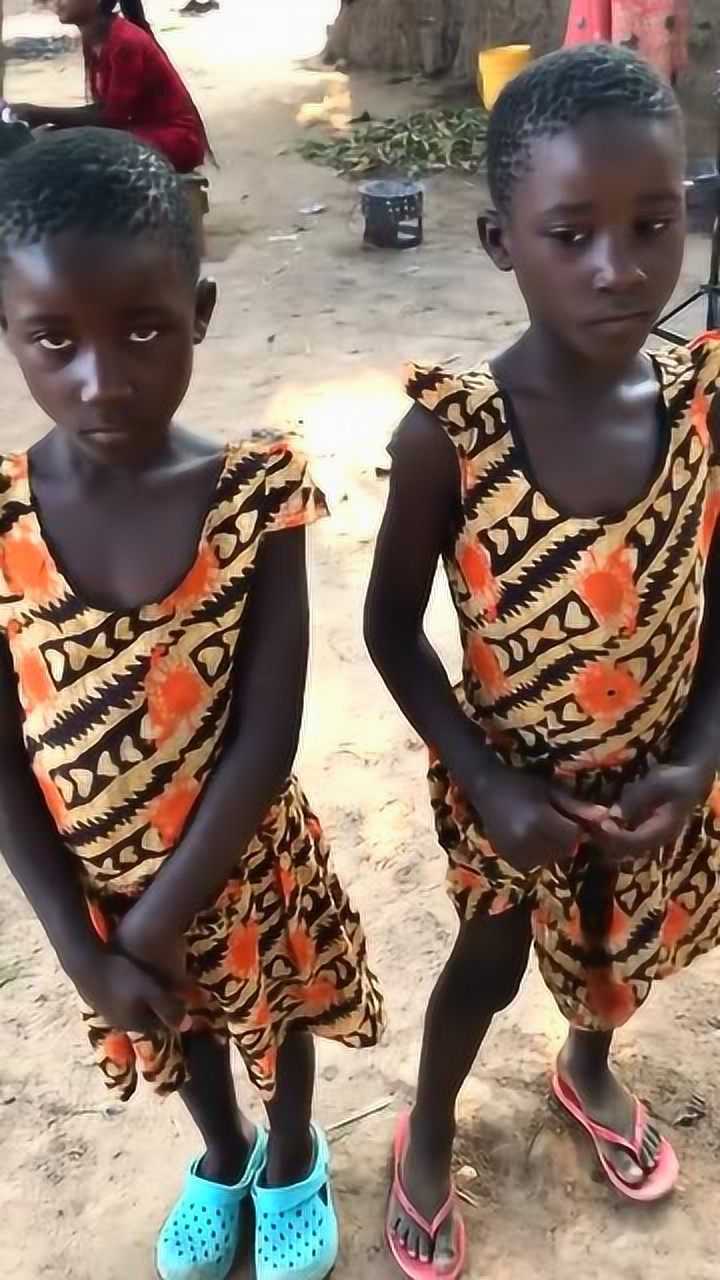 难得一见的非洲双胞胎,大家看像不像