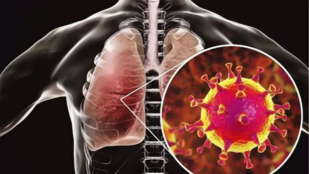 无症状感染者出现,为什么没有使武汉疫情2次爆发?专家给出解读