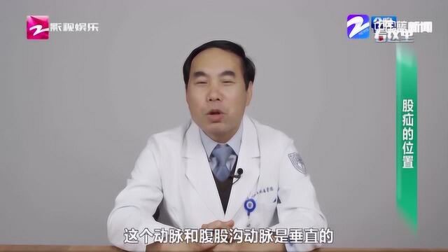 股疝的位置?医生:大多数出现在女性病人 先要鉴别是直疝还是斜疝