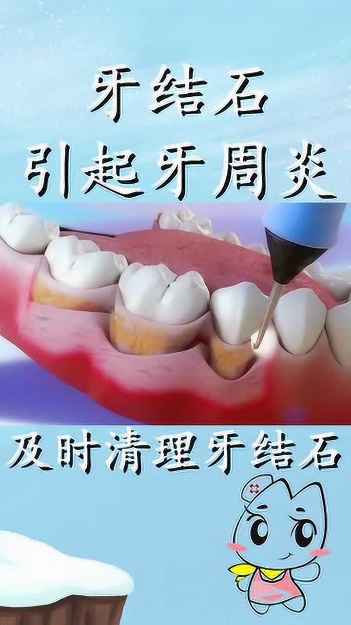 要及时清理牙结石不然很危险