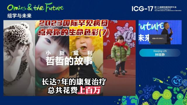 小胖威利婴儿期不会哭不会吃被误诊为脑瘫,长达7年的错误治疗花费上百万