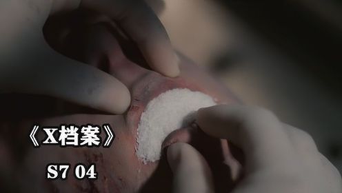 《X档案S7-04》法医发现死者嘴里都是粗盐，一旦取出粗盐就会尸变
