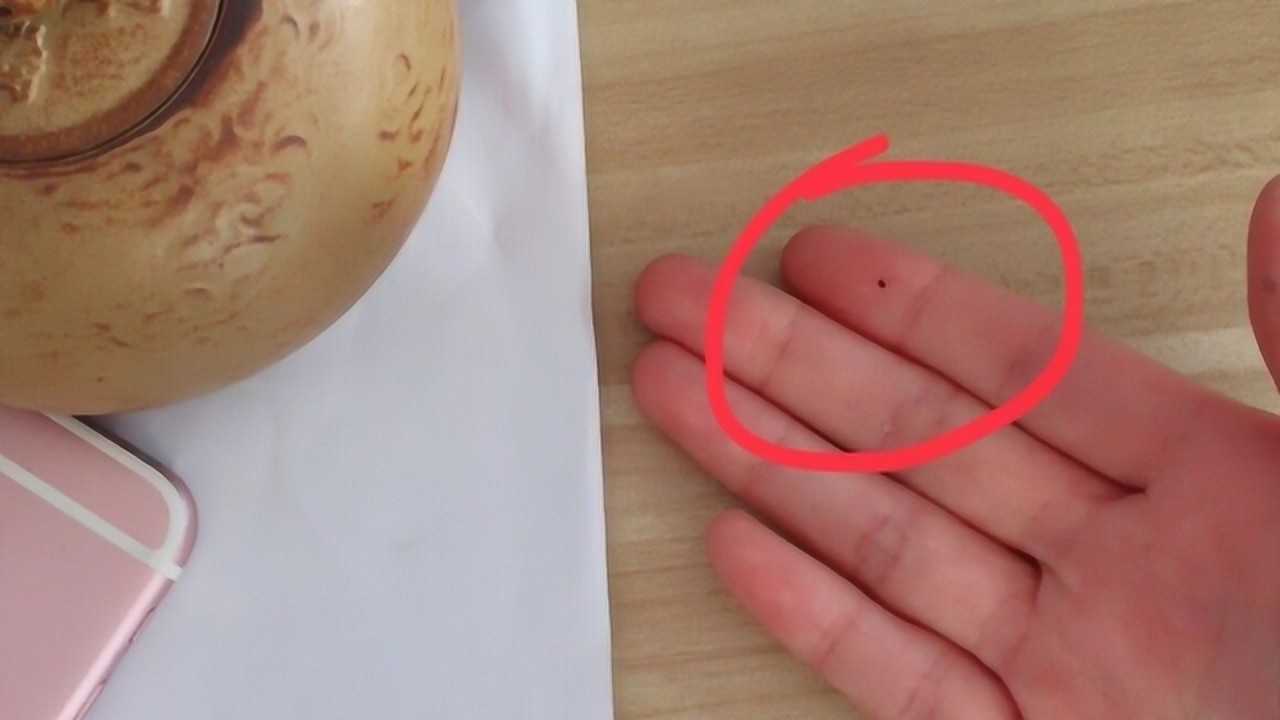 右手食指有痣的人有富贵命吗这种手相是什么样的运势呢