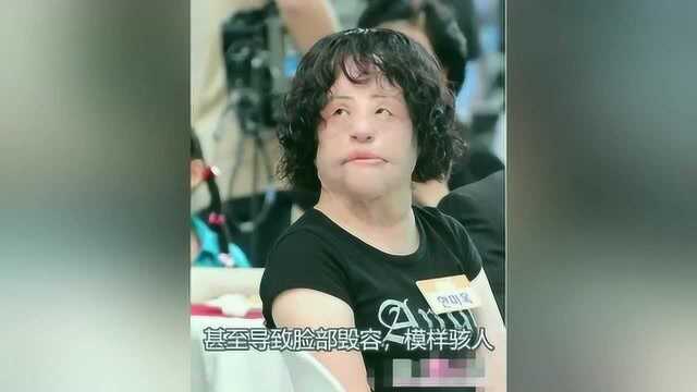 韩女星韩慧景57岁过世,生前脸部注射食用色拉油,死后无法闭眼