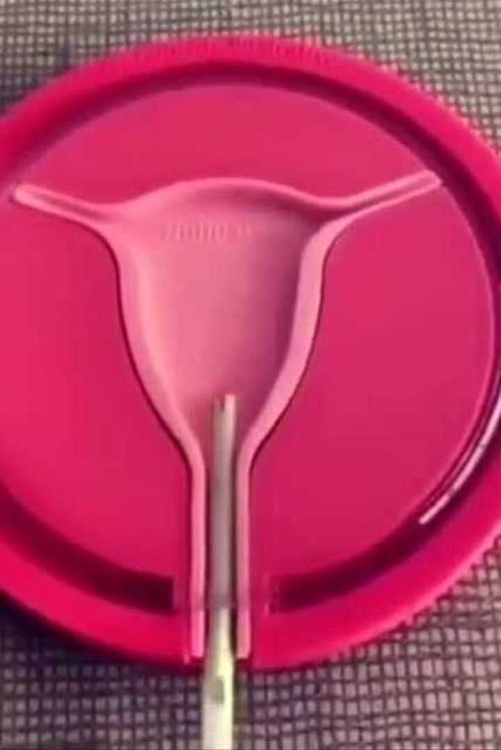 晚安了示意图告诉你节育环怎么放进去的