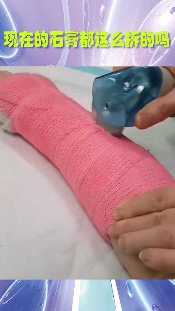 现在的石膏都这么拆的吗,我当时害怕极了