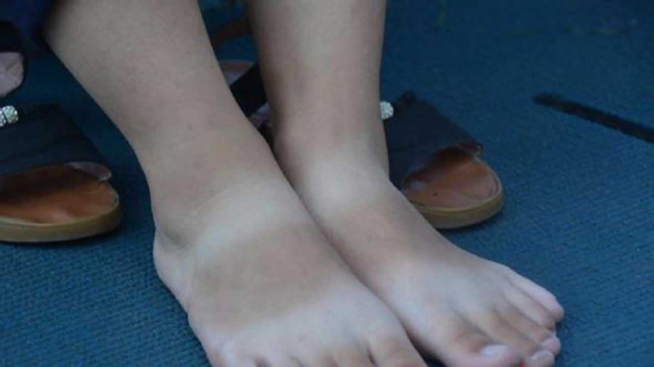 夏天穿凉鞋脚被晒黑每天涂点便宜货不出三天脚丫光滑白暂