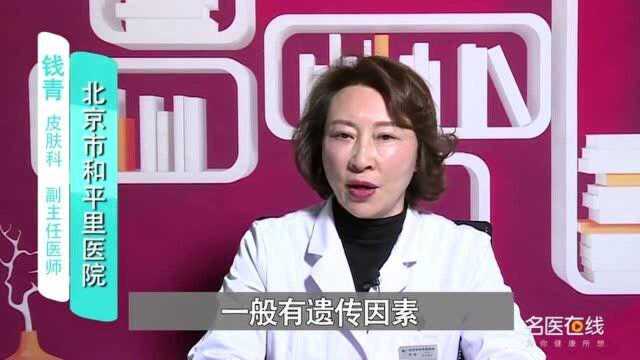 是什么造成白癜风这种“疾病”?四个原因帮你解答