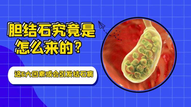 胆结石究竟是怎么来的?医生提醒:这6大因素或会引发结石病