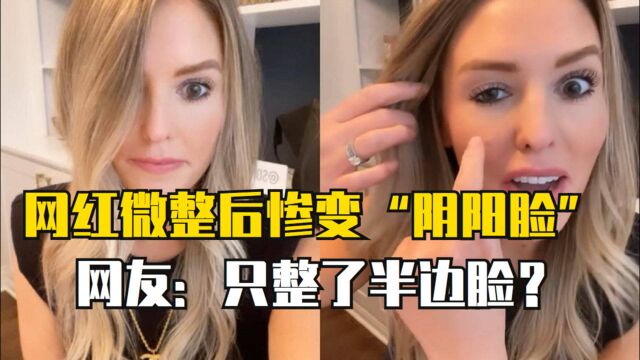 美一网红微整后惨变“阴阳脸”,体内就像有两个人?眼睑急剧下垂且难以恢复!