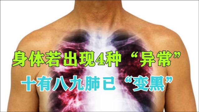 身体若出现4种“异常”,十有八九肺已“变黑”,肺癌或已靠近