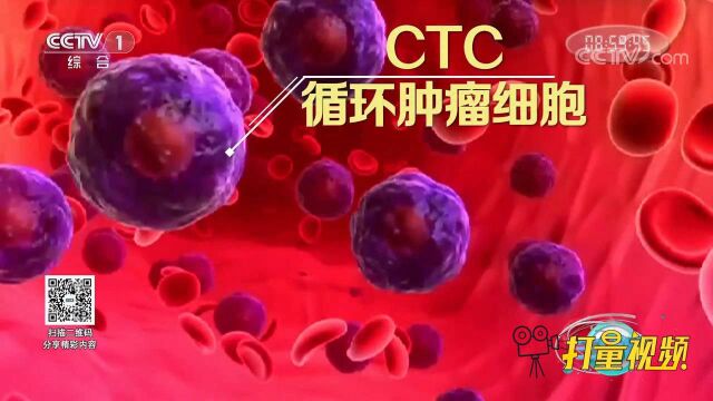 医疗新技术!CTC纳米检测技术,致力于发现早期肿瘤细胞