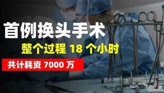 世界首例换头手术成功,整个过程18个小时,共计耗资7000万