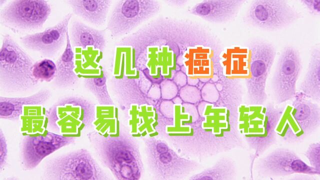 人人都会得癌?90、00后被盯上了!年轻人需要警惕的十大癌症!