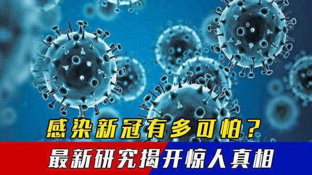 顶级医学杂志公开成果,新冠后遗症有多可怕?数据给所有人提了醒