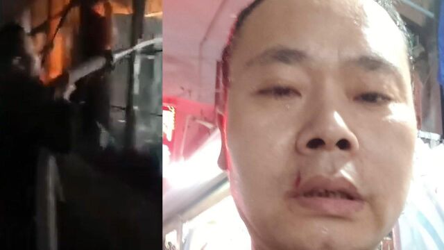 为他点赞!宜春一消防退伍兵挺身救火 多处被玻璃划伤