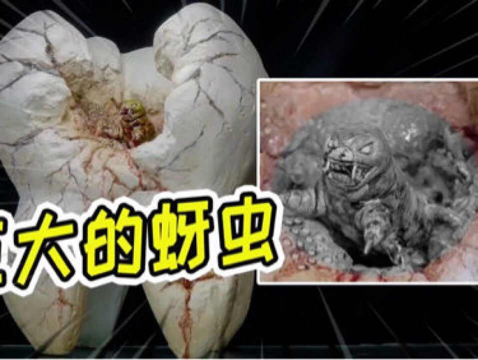 模型:在一棵牙齿里,生活中一头巨大的蚜虫!