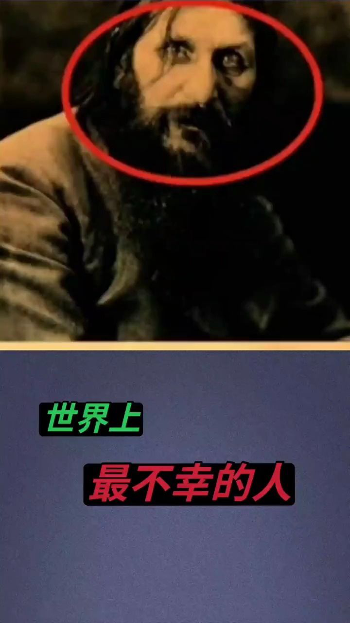 世界上最不幸的人。#奇闻异事#热点#科普_高清1080P在线观看平台_腾讯视频