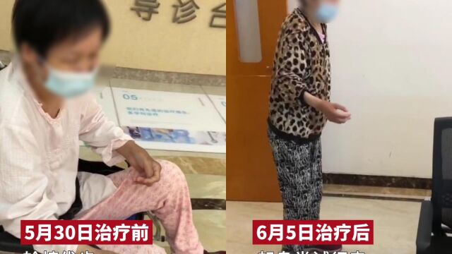 为什么类风湿治疗没效果?成都附大类风湿专科医院病人治疗前后效果,专业技术更让人们放心ⷀ