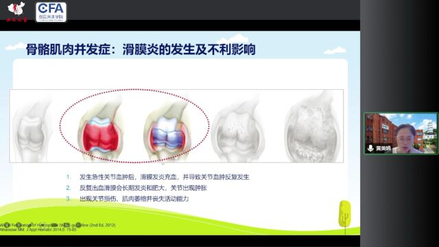 6月16号 回放 血友病患者的并发症管理 黄美娟