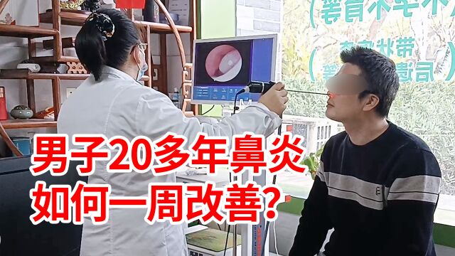 男子20多年鼻炎,鼻塞严重,如何一周改善?经典案例分享