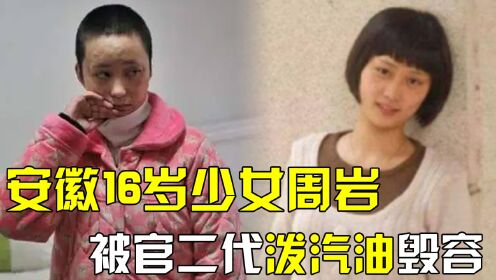 安徽16岁少女周岩，因拒绝官二代追求被泼汽油，她现在怎么样了