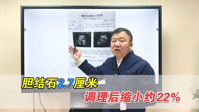 体检查出2.7厘米胆结石?中医疏肝利胆、化石排石,结石缩小22%