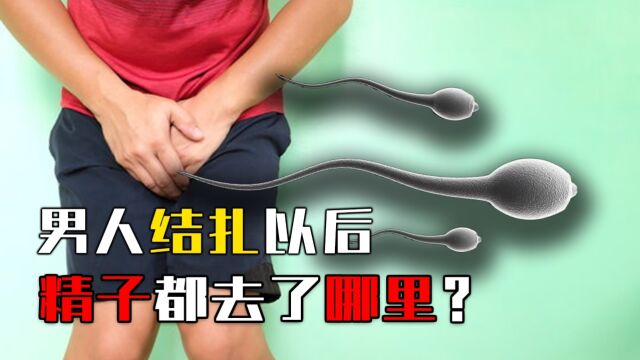 男人结扎以后,精子都去了哪里?男女结扎有何不同?