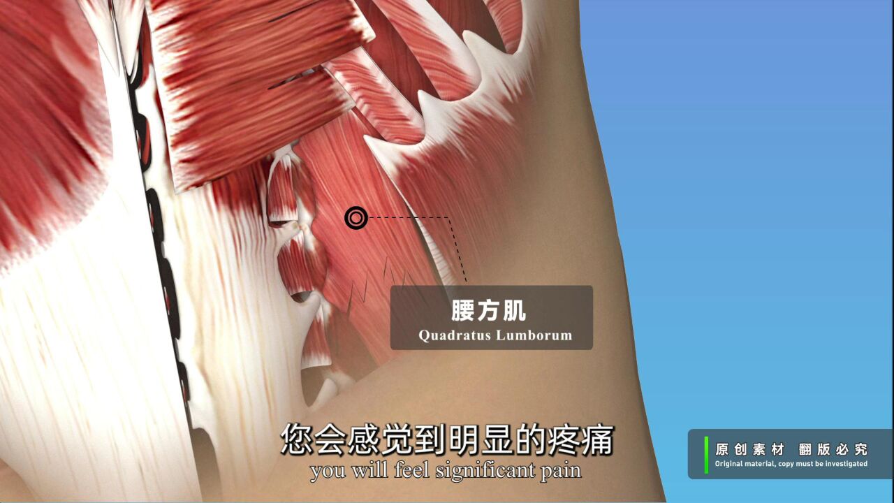腰部肌肉拉伤千万不要立即热敷按摩!正确冷敷事半功倍
